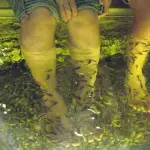 Pedicure con i pesci finisce con l'amputazione delle dita per una donna