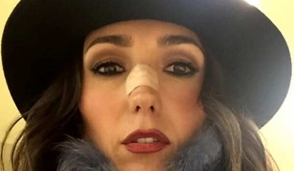 Caterina Balivo, “frontale” contro una porta a vetri